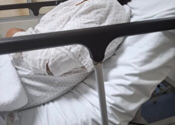 En Xalapa, se busca a las dos mujeres responsables de lanzar aceite hirviendo contra empleada de antojitos