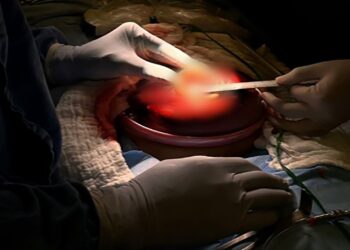 Veracruz hace historia: realizan con éxito la primera cirugía fetal en hospital público