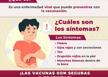 Confirma Secretaría de Salud federal primer caso de Sarampión en Xalapa