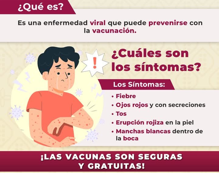 Confirma Secretaría de Salud federal primer caso de Sarampión en Xalapa