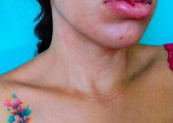 Sulma Guadalupe Escobar teme que su pareja recupere su libertad tras intentar matarla