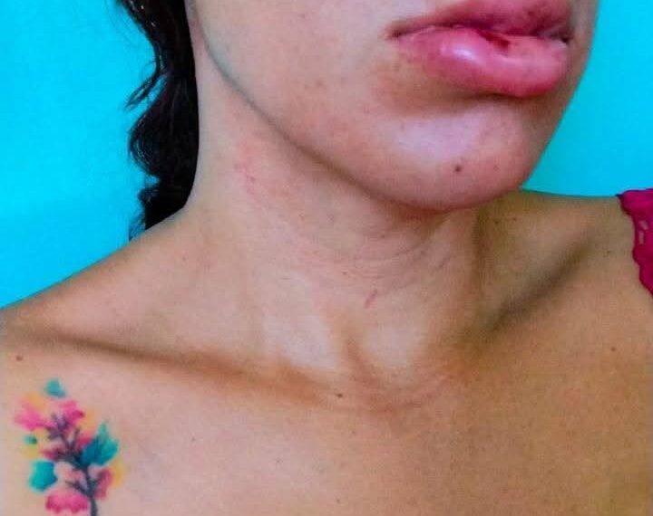 Sulma Guadalupe Escobar teme que su pareja recupere su libertad tras intentar matarla